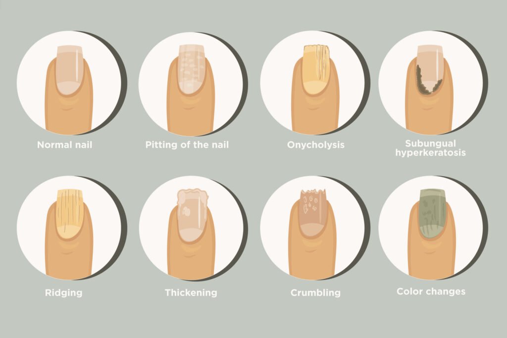 What Are Your Nails Saying? Decoding Common Nail Problems & Getting Healthy Nail